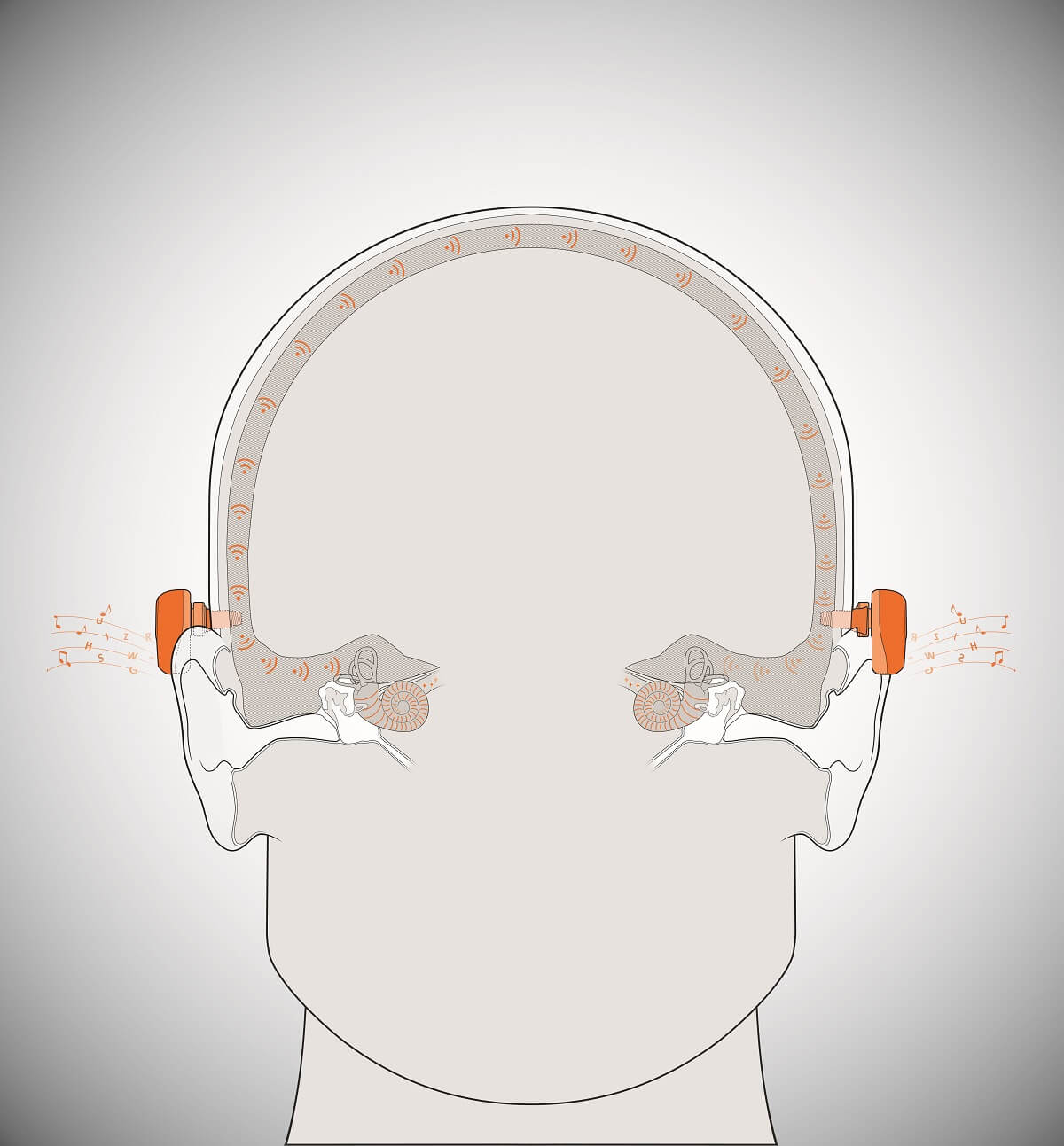 Oticon Medical Ponto bone-anchored hearing system