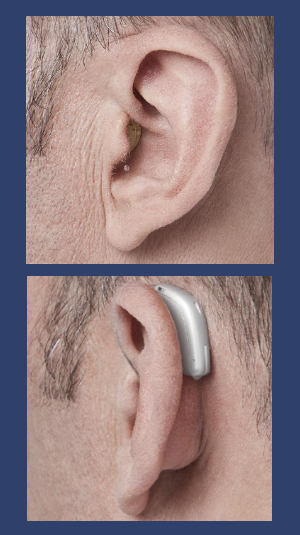 Pictures of hearing aids, including pictures of in-the-ear hearing aid and picture of behind-the-ear hearing aid